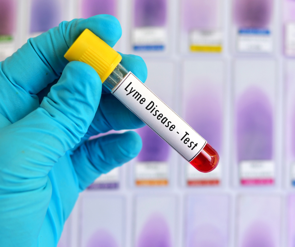 Test for Lyme disease