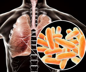 legionella bacteria - You Drug Mart legionella bacteria